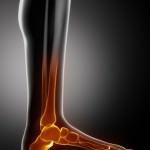 All About Foot Orthotics Podiatry Group of Georgia