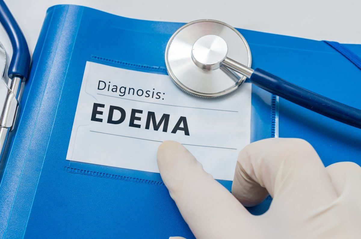 Edema Podiatry Group Of Group