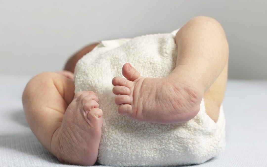 Amniotic Band Syndrome